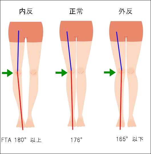 膝関節のFTAの正常角度は？測定法も詳しくご紹介します3